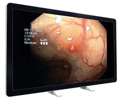 RCC-MS-GMD55G(T)